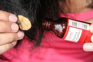 Tsiklosporin y las revocaciones a la psoriasis