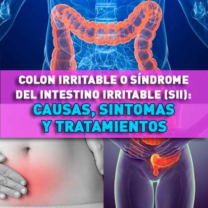 Sintomas del colon irritable o síndrome del intestino irritable en los