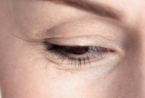 El corrector para la persona sobre las ojeras oscuras