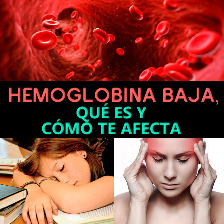 Hemoglobina Baja Causas S Ntomas Y Tratamiento La Gu A De Las Vitaminas