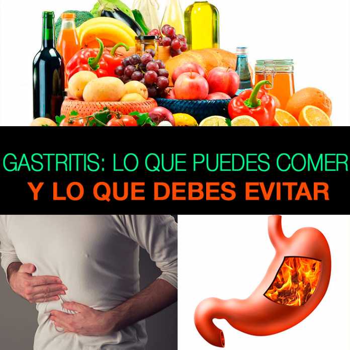 Gastritis Lo Que Puedes Comer Y Lo Que Debes Evitar La Gu A De Las