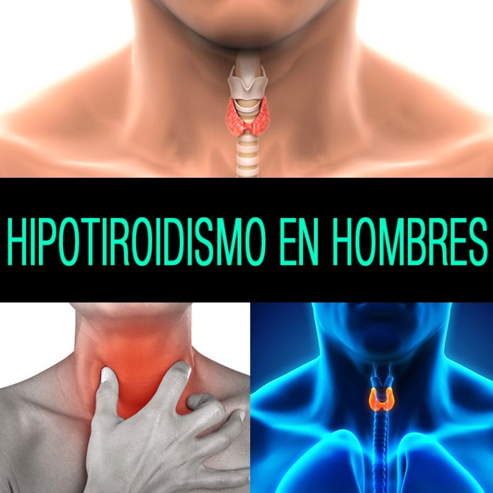 Hipotiroidismo En Hombres S Ntomas Causas Y Tratamiento La Gu A De