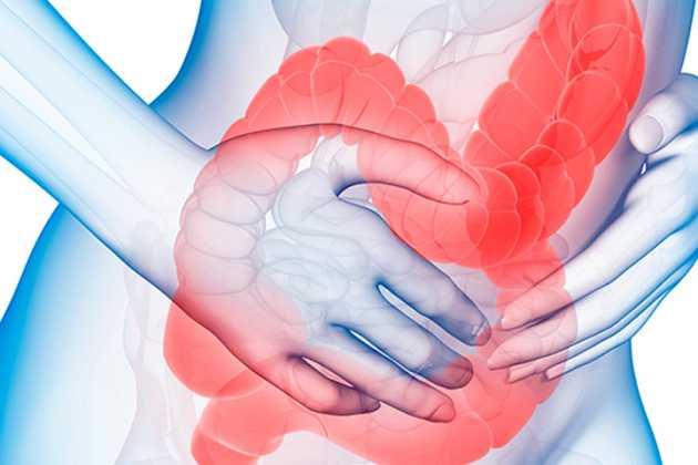 Colon Irritable O Síndrome Del Intestino Irritable Sii Causas Síntomas Y Tratamiento La 2519