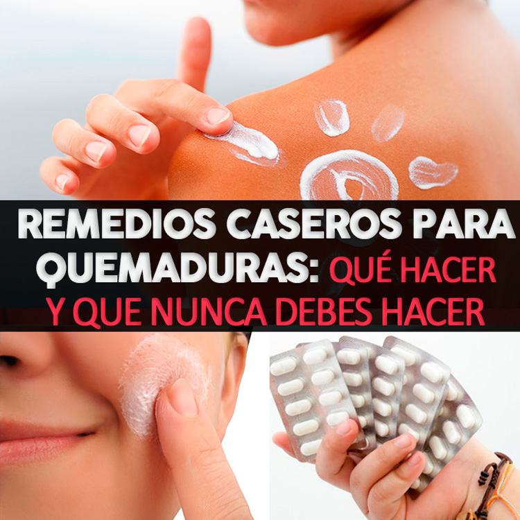 Remedios Caseros Para Quemaduras: Qué Hacer Y Que Nunca Debes Hacer ... Remedios Caseros Para Quemaduras: Qué Hacer Y Que Nunca Debes Hacer ...