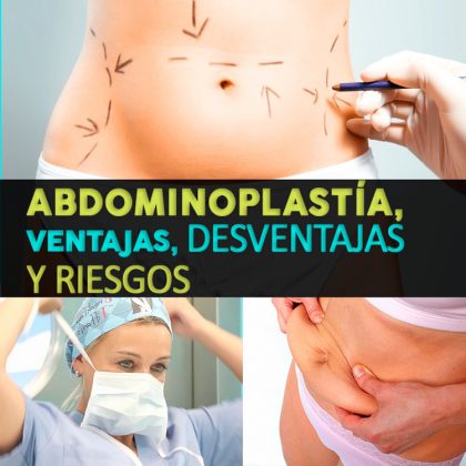 Abdominoplastia: ventajas, desventajas y riesgos - La Guía de las Vitaminas