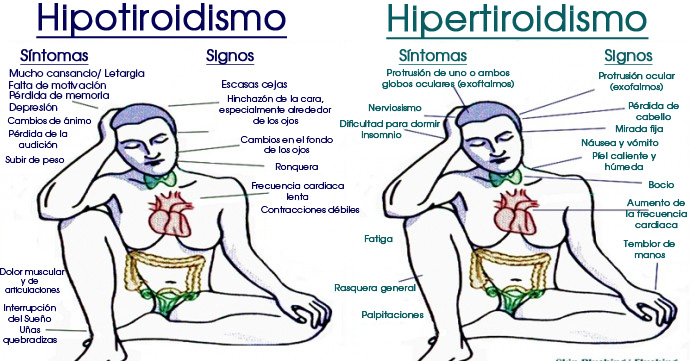 Todos los signos, síntomas, desencadenantes y tratamientos del hipotiroidismo e hipertiroidismo
