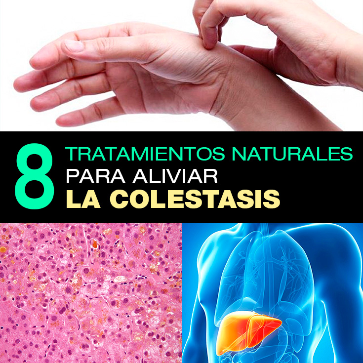 Colestasis qué es, causas y 8 tratamientos naturales La Guía de las