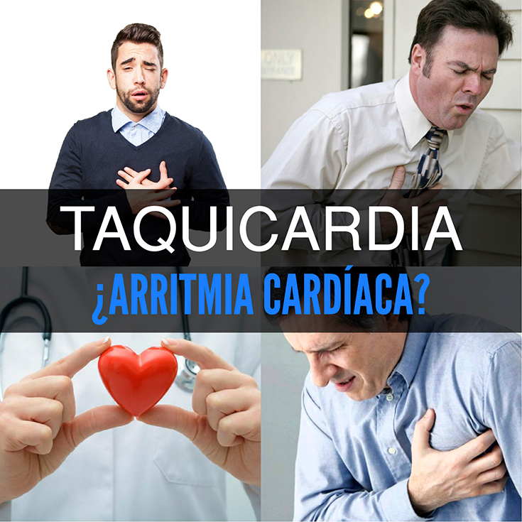Taquicardia causas, síntomas y tratamiento La Guía de las Vitaminas