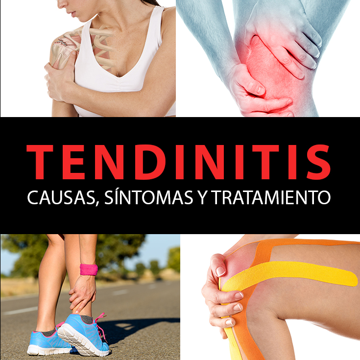 Tendinitis Causas Síntomas Y Tratamiento La Guía De Las Vitaminas 1150
