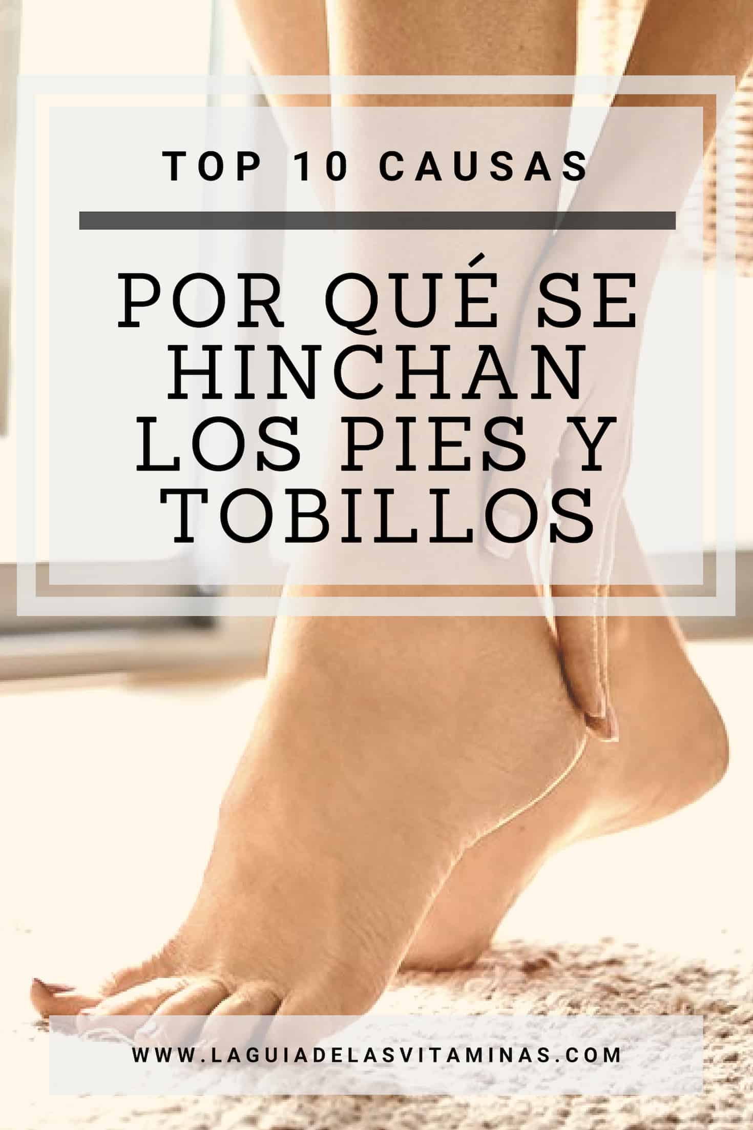 Top 10 Causas De Por Que Se Hinchan Los Pies Y Los Tobillos | La Guía ...