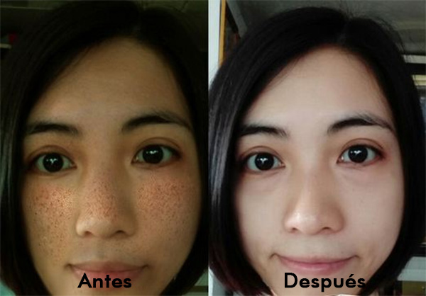 Cómo aclarar la piel naturalmente, rápido, efectivo y seguro - La Guía