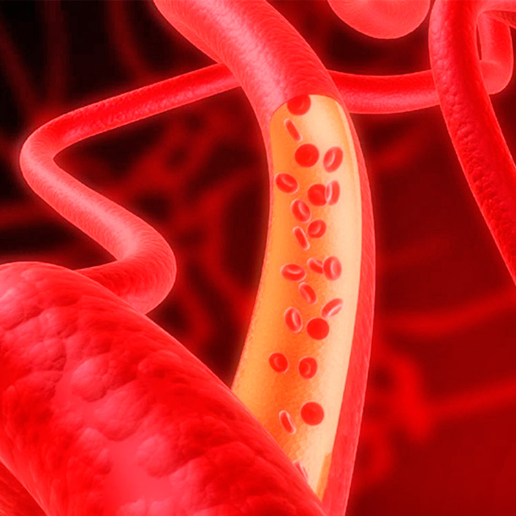 Cómo subir tus niveles de hemoglobina: 7 formas naturales