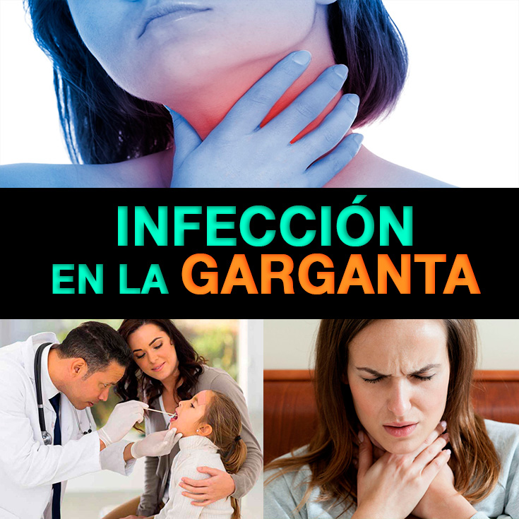 Infección En La Garganta: Causas, Síntomas Y Tratamiento