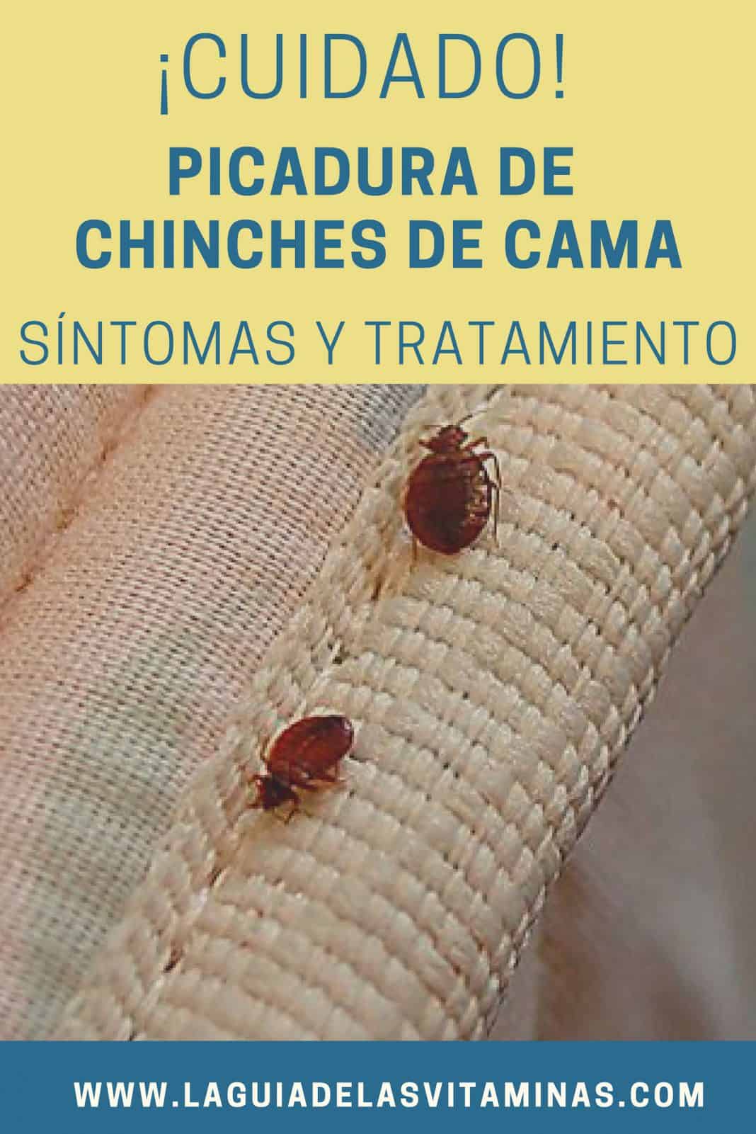 Picadura De Chinches De Cama: Síntomas Y Tratamientos - La Guía De Las ...