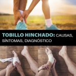 Tobillo-hinchado-causas-síntomas-diagnóstico