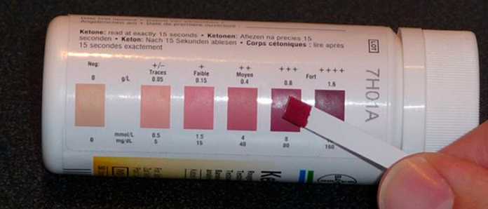 Cuerpos cetónicos en la orina: qué significa - La Guía de las Vitaminas