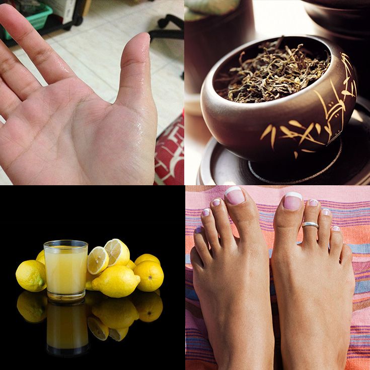 26 remedios caseros para el sudor de pies y manos
