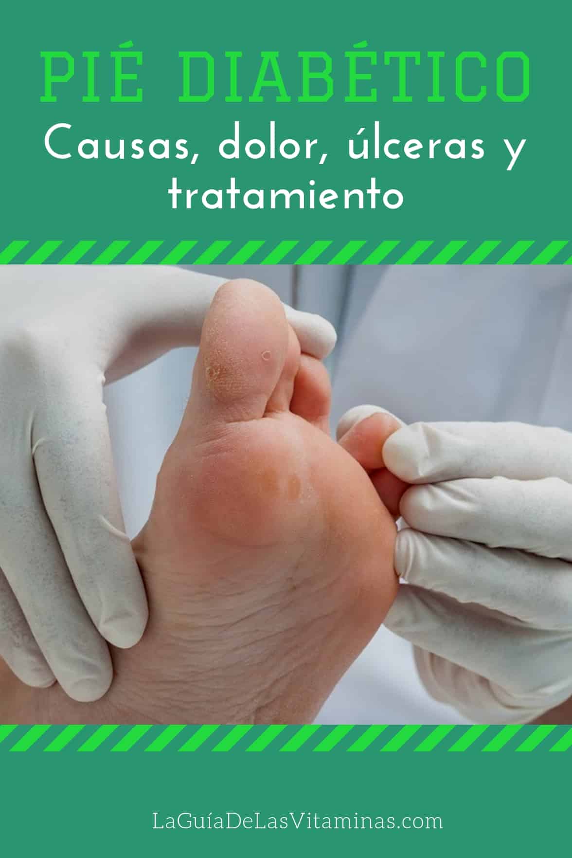 Pie Diabético_ Causas, Dolor, Úlceras Y Tratamiento | La Guía De Las ...