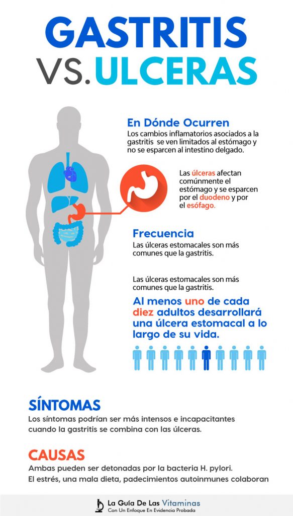 Síntomas de gastritis, aparecen en la mayoría de los casos