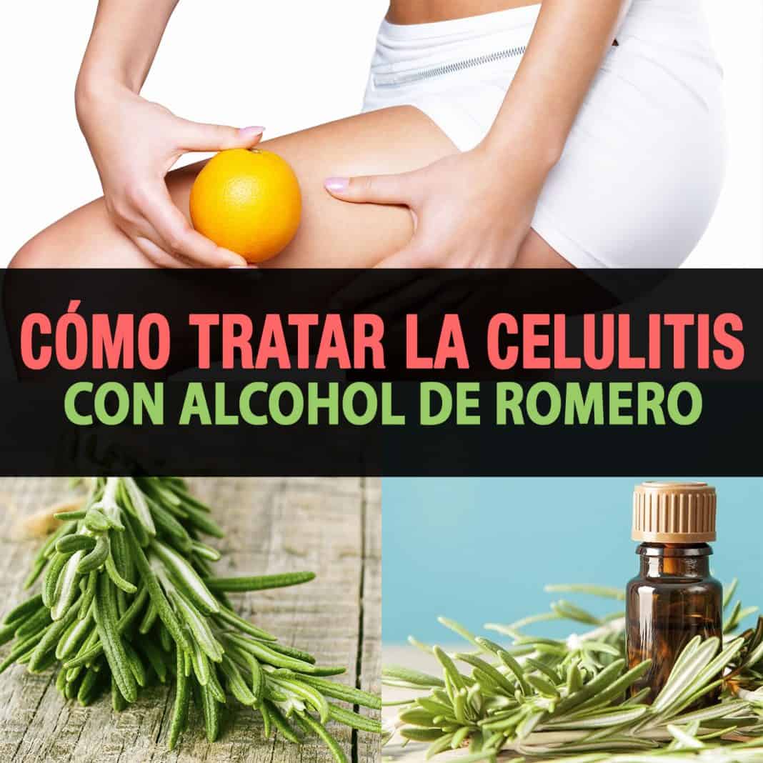 Cómo Tratar La Celulitis Con Alcohol De Romero La Guía De Las Vitaminas 1433