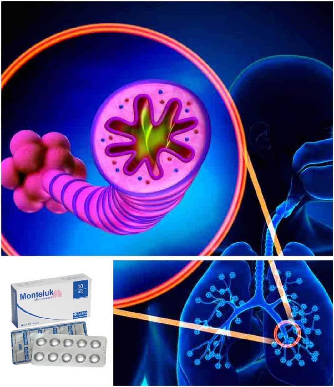 Montelukast para qué sirve, efectos secundarios, usos y dosis La Guía de las Vitaminas