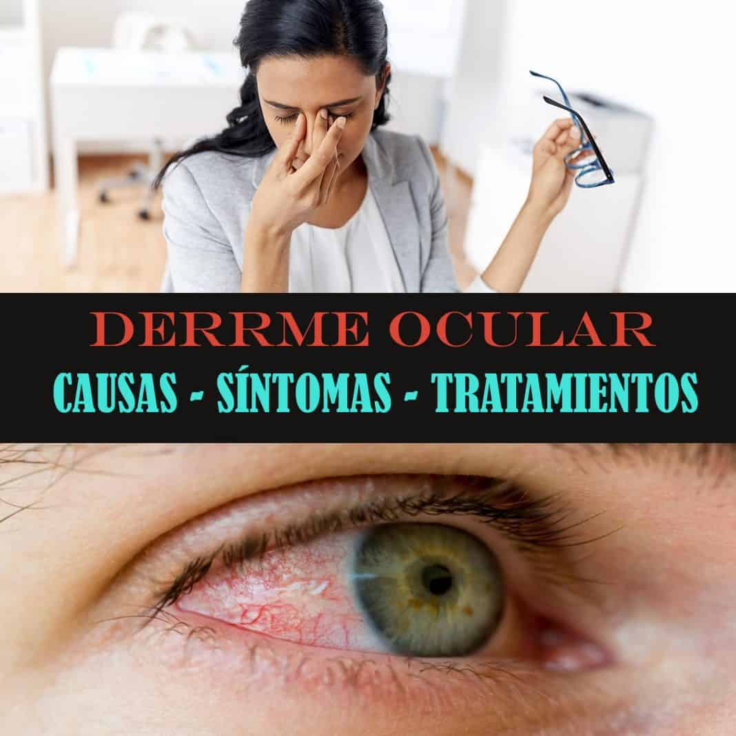 Derrame Ocular Causas S Ntomas Y Tratamiento La Gu A De Las Vitaminas